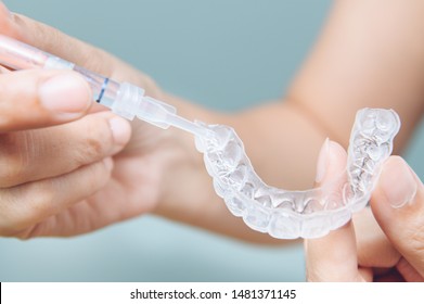 Tooth whitening gel being applied to a tooth mold in preparation for being placed in the mouth. - Shutterstock ID 1481371145
