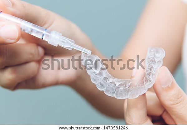 Tooth whitening gel being\
applied to a tooth mold in preparation for being placed in the\
mouth.