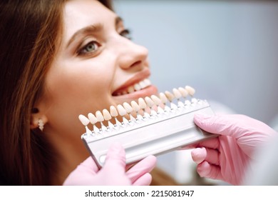 Tooth whitening, perfect white teeth close up with shade guide bleach color. Healthy teeth and medicine concept. - Shutterstock ID 2215081947