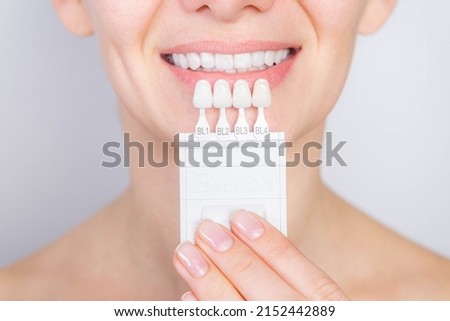 Tooth whitening, perfect white teeth close up with shade guide bleach color, female veneer smile, dental care and stomatology, dentistry