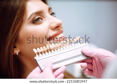 Tooth whitening, perfect white teeth close up with shade guide bleach color. Healthy teeth and medicine concept.
