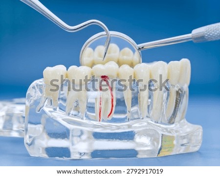 Toothache and pulpitis diagnosis. Macro view of clear jaw model highlighting root canals with dental instruments on blue background.