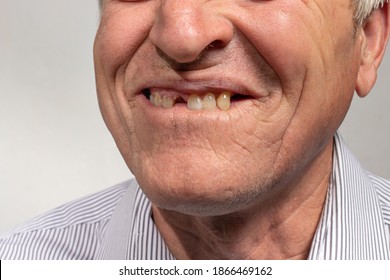 Senza Denti Immagini Foto Stock E Grafica Vettoriale Shutterstock