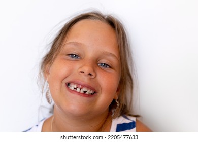 Toothy Smiling, Carefree, Playful Little Blonde Girl Showing Baby Temporary Milk Teeth Against White Wall. Toothless Mouth Smile And Crooked Teeth. Orthodontic, Dental Work. Tooth Loss, Change