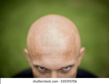 top-front-bald-mans-head-260nw-535593706.jpg