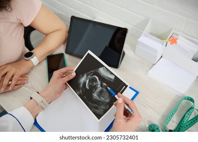 Top view of the hands of an ultrasound diagnostic doctor, obstetrician-gynecologist holds ultrasound scan, explains to pregnant woman the development of child in womb. Planned ultrasound 2nd trimester - Powered by Shutterstock