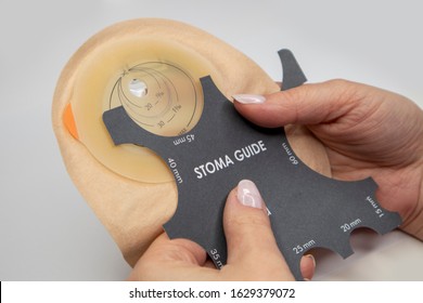 Top view on colostomy bag needed after colostomy surgery - colon cancer treatment. Ostomy bag with filter in skin color. Medical theme. Stoma bag and stoma guide in woman’s hands.