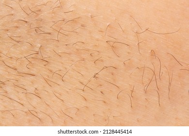 Top view Skin human hairy macro. Close up view of fresh new regrowing hair - Shutterstock ID 2128445414