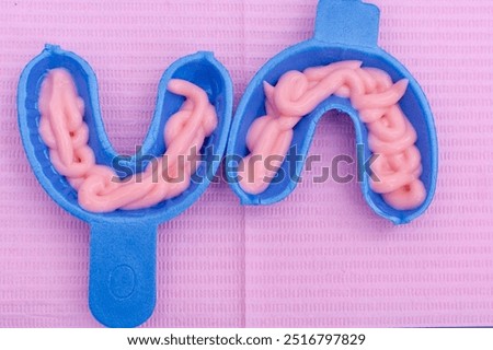 Top view of two blue fluoride gel foam trays filled with pink fluoride gel. These trays are used during fluoride treatment to strengthen teeth and prevent cavities in a dental settin