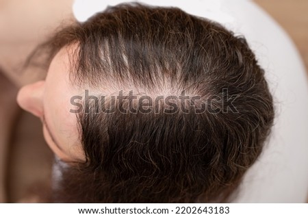 Top view of a woman with hair loss and no volume