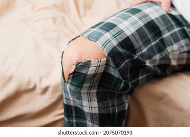 Torn Pants, Hole In Place Of Knee, Problem With Clothes. Close-up Of Man Showing Spoiled Home Clothes, Indoors.