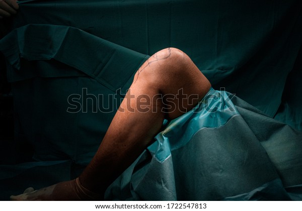 TOTAL\
KNEE ARTHROPLASTY REPLACEMENT SURGERY\
ORTHOPAEDI