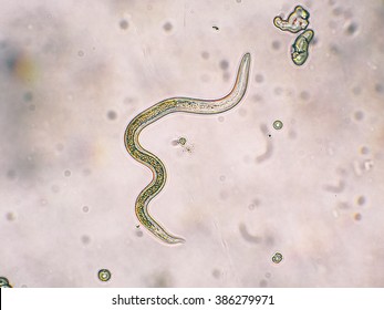 Toxocara canis second stage larvae hatch from eggs