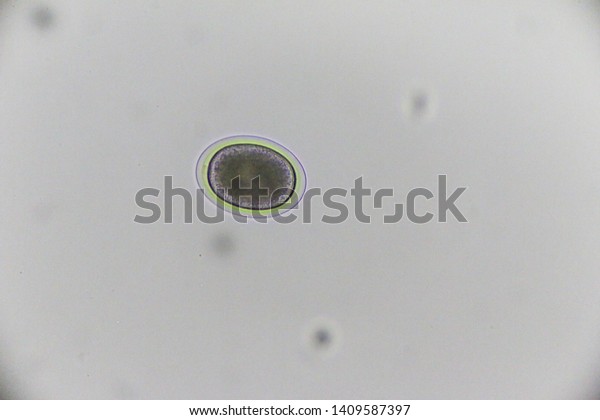 Toxocara Canis Under Microscope Stock Photo (Edit Now) 1409587397