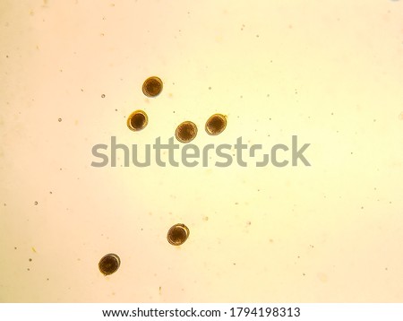 toxocara cati egg under the microscope