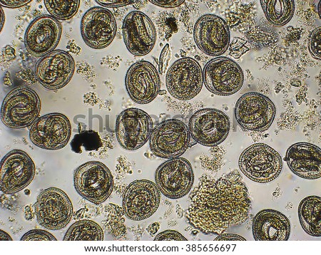 Toxocara cati L-2 larvae in eggs microscope