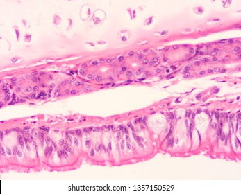 232 Cartilage rings Images, Stock Photos & Vectors | Shutterstock