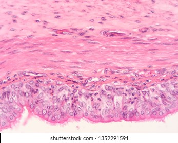 Trachea Esophagus Human Tissue Stock Photo 1352291591 | Shutterstock