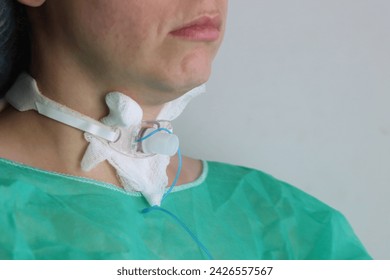 Tracheostomy in a patient neck. Patient with hospital clothes wearing tracheostomy  - Powered by Shutterstock