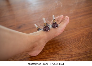 Traditional Chinese Medicine Treatment Foot Moxibustion Physical Therapy