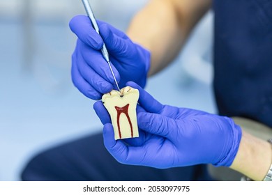 Training, Education, Practicing Dentist Work. Demonstration Different Stages Caries On Model On Jaw For Patient. Mock Of Diseases Teeth In Dental Clinic. 