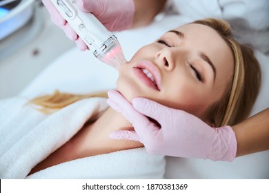 Tranquil patient being treated using a fractional radio frequency microneedle machine with a vacuum suction