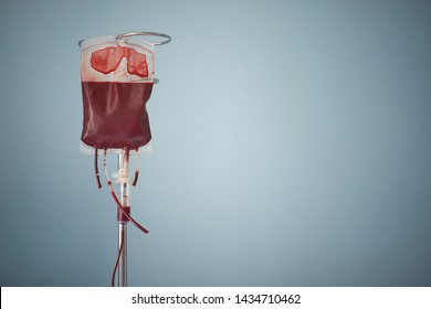 transfusion of blood, bag with red blood cells on stand. Blue background with copy space