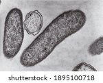 Transmission electron microscope photo of vibrio bacteria x76000