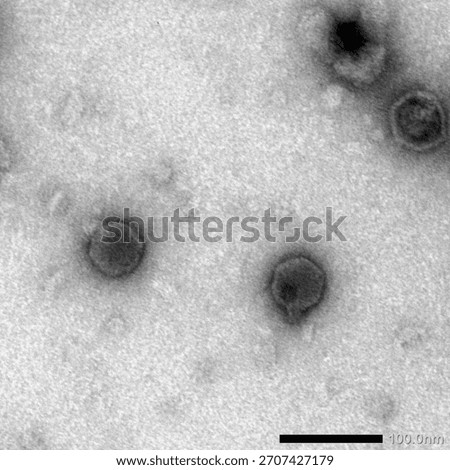 Transmission electron microscope (TEM) image of bacteriophage viruses. Phage particles show hexagonal capsids. Real micrograph of viruses that infect bacteria, used in phage therapy research. Scale ba