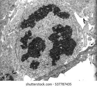 Transmission Electron Microscope (TEM) Micrograph Of A Mitotic Cell In Prometaphase Stage Showing Chromosomes And Remains Of Nuclear Envelope Breakdown.