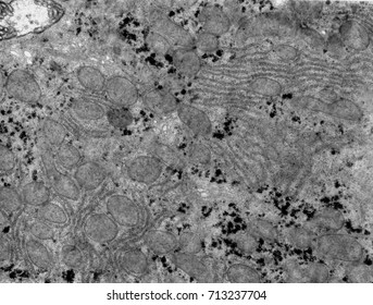 Transmission Electron Microscope (TEM) Micrograph Showing Several Organelles (mitochondria, Glycogen, RER) In The Cytoplasm Of A Hepatocyte. 