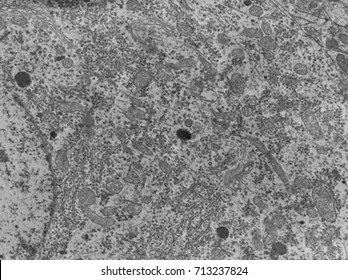 Transmission Electron Microscope (TEM) Micrograph Of A Neuron Cell Body Showing Mitochondria, Lysosomes, RER, Golgi System, And The Nucleus (left).