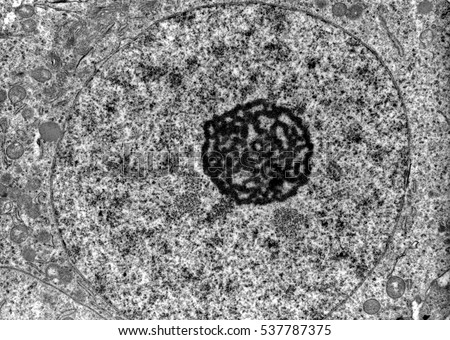 Transmission electron microscope (TEM) micrograph showing the ultrastructure of a nucleus with a very prominent nucleolus and a remarkable nuclear envelope. 