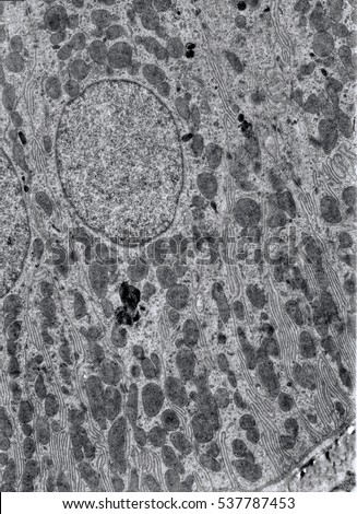 Transmission electron microscope (TEM) micrograph showing of a kidney convoluted tube cell. The basal infoldings with numerous mitochondria associated can be seen. Dense bodies are lysosomes.