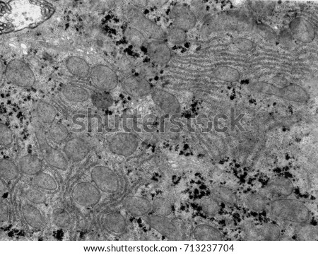 Transmission electron microscope (TEM) micrograph showing several organelles (mitochondria, glycogen, RER) in the cytoplasm of a hepatocyte. 