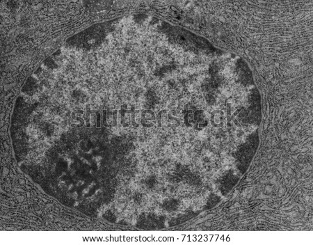 Transmission electron microscope (TEM) micrograph showing the nucleus of a protein-synthesizing cell. The nuclear envelope, chromatin and nucleolus can be seen. The cytoplasm is full of RER.