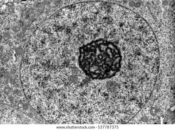 Micrographe Du Microscope Electronique A Transmission Photo De Stock Modifiable