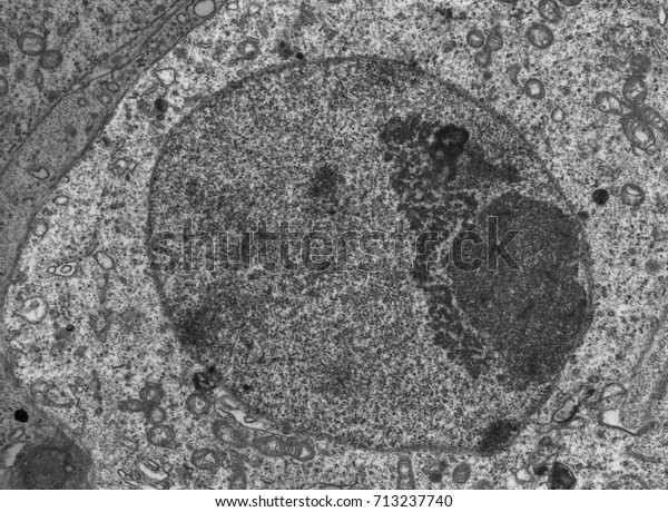 Transmission Electron Microscope Tem Micrograph Showing Stock Photo ...