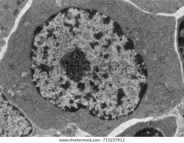 Transmission electron microscope (TEM)\
micrograph of a B-lymphocyte at the onset of its activation. RER\
cisterns begin to appear In a cytoplasm full of\
ribosomes.
