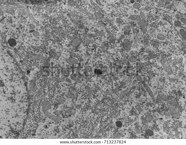 Transmission Electron Microscope Tem Micrograph Neuron Stock Photo Edit Now Transmission Electron Microscope Tem Micrograph Neuron Stock Photo Edit Now