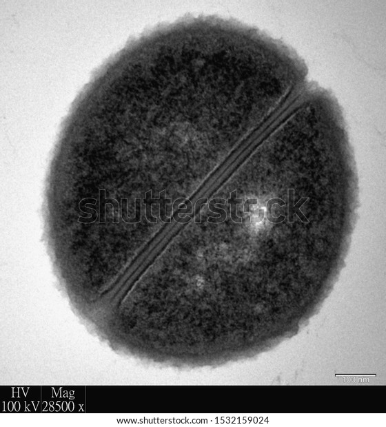 Transmission Electron\
Microscopy of bacteria showing cell division by binary fission.\
This is an important process in bacteria which leads to the\
production of new\
cells.