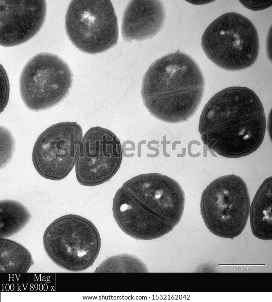 Transmission electron microscopy image of bacteria\
showing Staphylococcus undergoing binary fission. We can see both\
dividing and divided\
cells.