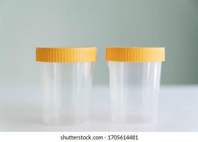 Transparent empty plastic urine container with yellow lid isolated on white background. Sterile container for analysis. Closed container. Yellow cap