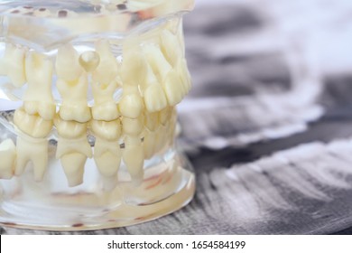 A Transparent Model Of The Human Jaw With Permanent And Deciduous Teeth In An X-ray.
