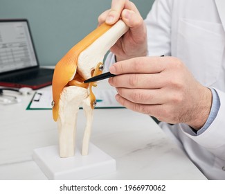 Traumatologist Pointing Pen To Meniscus In A Knee-joint Anatomical Teaching Model, Close-up. Human Torn Meniscus Treatment Concept