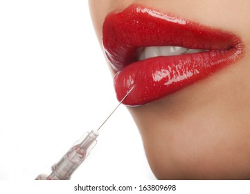 Treatment with botox hyaluronic collagen HA injection