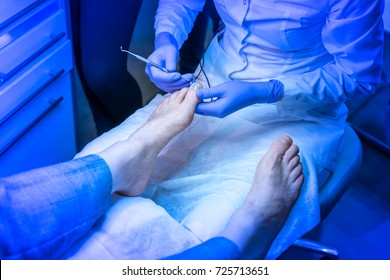 Treatment Of Nails. Ingrown Nail.