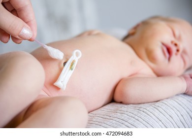 Treatment of newborn baby navel with a cotton swab.