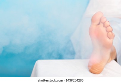 Treatment of warts on the sole of the foot and corns with liquid nitrogen and cryotherapy, plantar wart and corns, dermatology