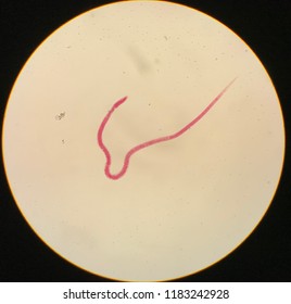 Trichinella Spiralis Adult In Light Microscope